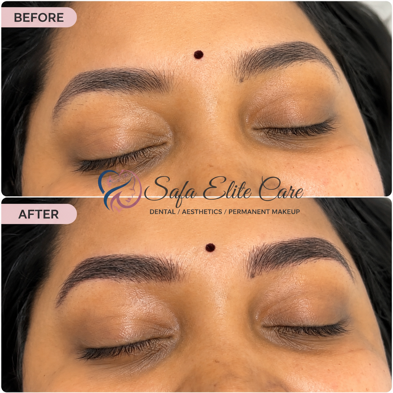 Eyebrow Microblading Before & After Case 2