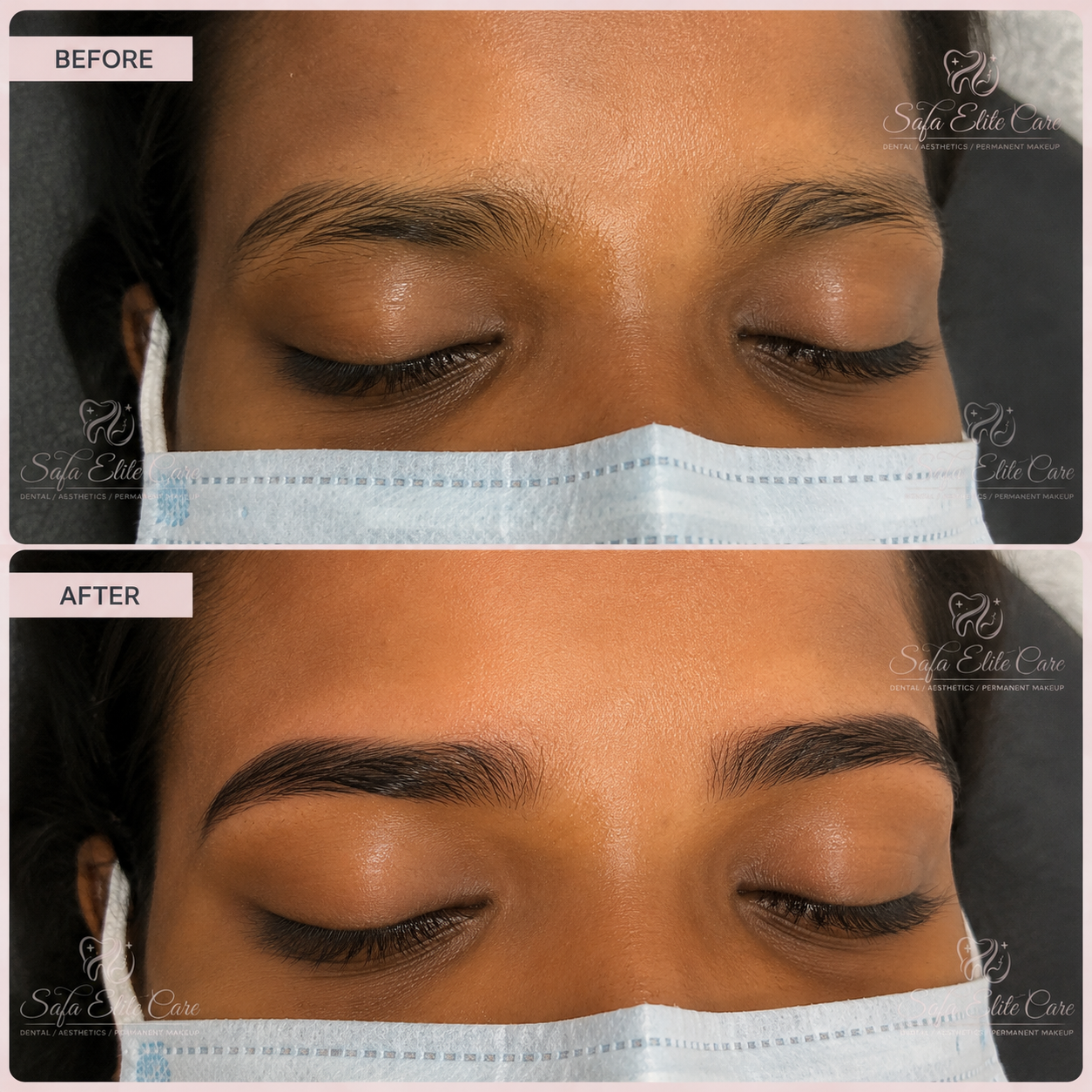 Eyebrow Microblading Before & After Case 3